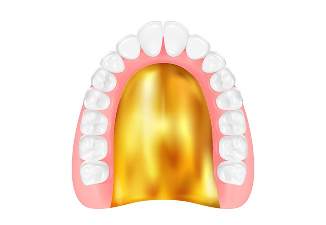 ゴールド床義歯